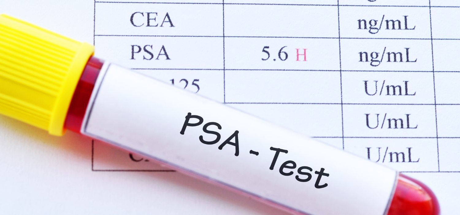 αυξημένο PSA psa test