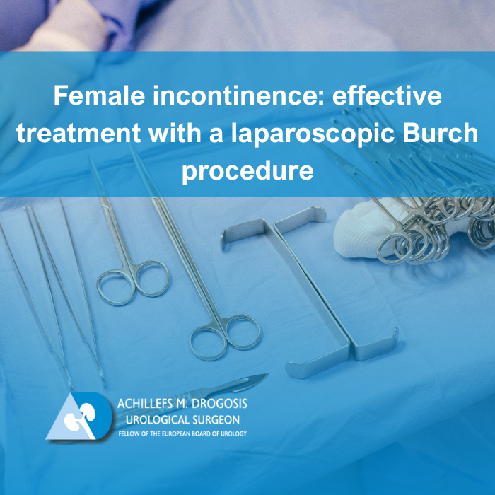 Read more about the article Female incontinence: effective treatment with a laparoscopic Burch procedure