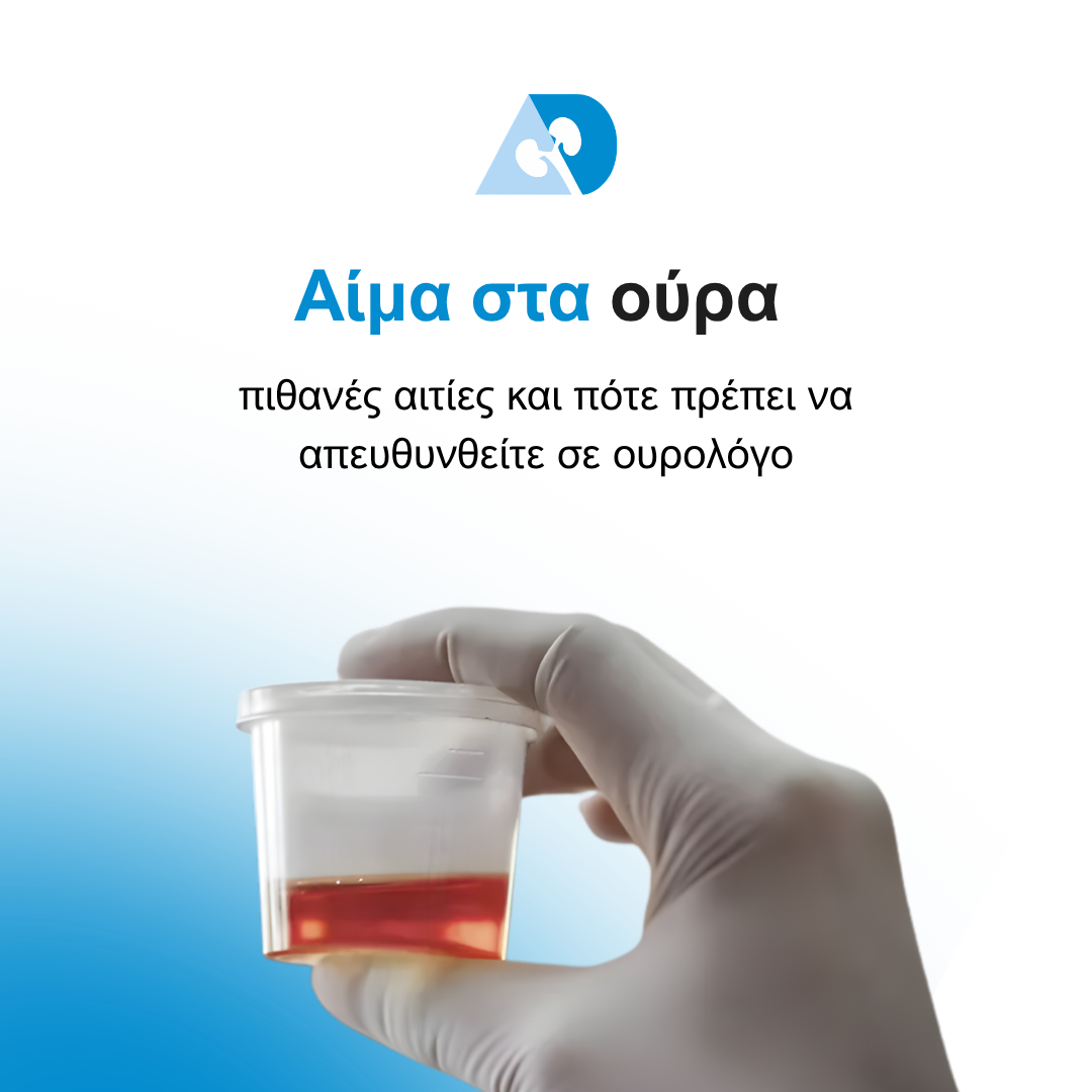 Read more about the article Αίμα στα ούρα: πιθανές αιτίες και πότε πρέπει να απευθυνθείτε σε ουρολόγο
